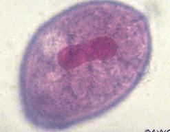 Balantidium The Parasite Balantidium coli