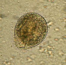 Balantidium coli httpsuploadwikimediaorgwikipediacommonsthu