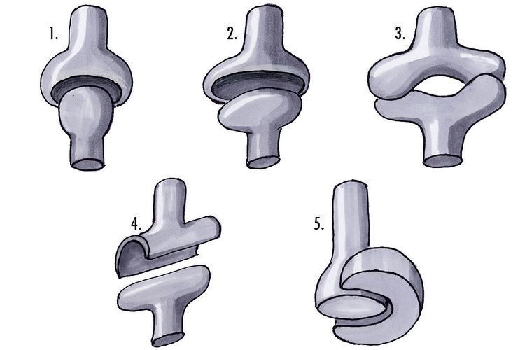 Ball and socket joint