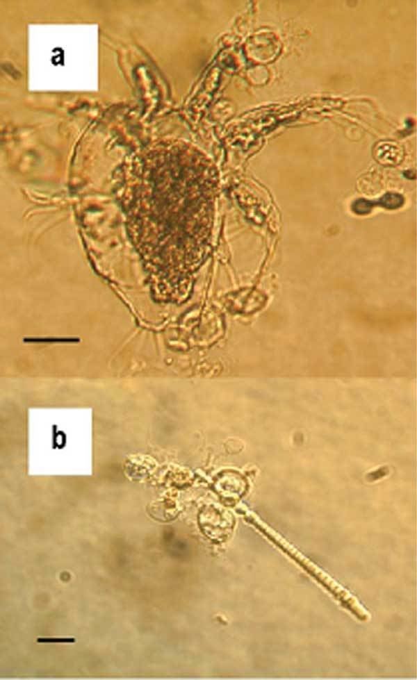 Batrachochytrium dendrobatidis.jpg