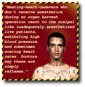 Beating heart cadaver httpssocietystacktracefileswordpresscom2012