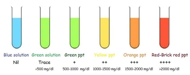 Different colors of Benedict's reagent inside flasks and the amount of sugar that each color corresponds.