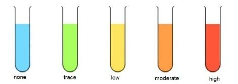Different colors of Benedict's reagent inside flasks and the amount of sugar that each color corresponds.