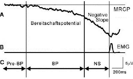 Bereitschaftspotential When looking at a Bereitschaftspotential BP signal three