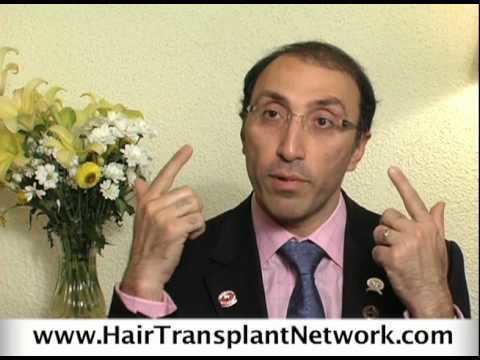 Bessam Farjo Hair Transplant Achieving Excellent Hair Transplant