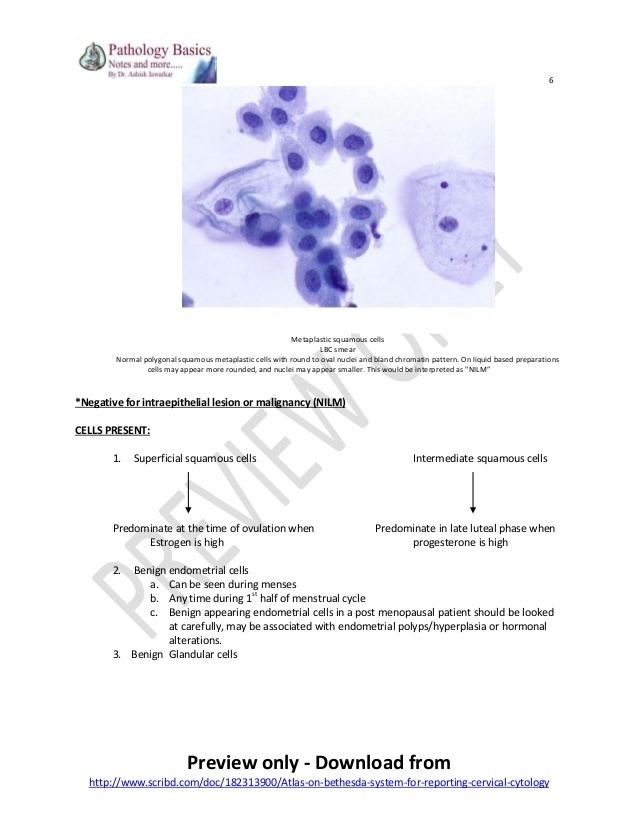 Bethesda system Atlas on bethesda system for reporting cervical cytology