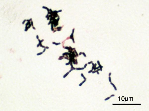 Bifidobacteriales