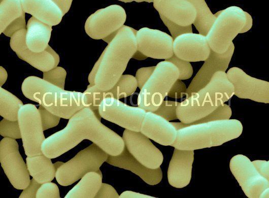 Bifidobacterium bifidum Bifidobacterium bifidum Stock Image B2201561 Science Photo Library