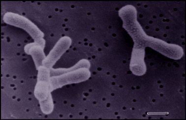 Bifidobacterium Bifidobacterium MicrobeWiki