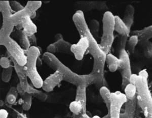Bifidobacterium longum The role of Bifidobacterium longum in a healthy human gut community