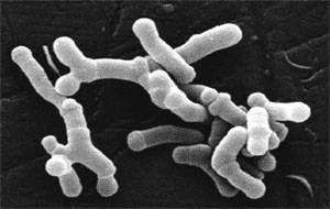 Bifidobacterium longum Bifidobacterium longum MicrobeWiki