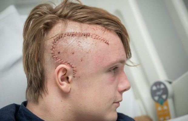 Billy Whitaker Billy Whitaker Epileptic Teen Cured By Surgeons Using Sat Nav