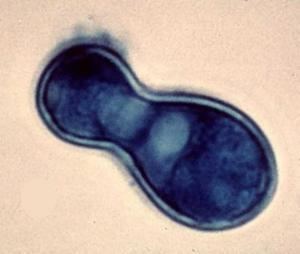 Blastomyces dermatitidis Blastomyces dermatitidis cause of blastomycosis Tom Volk39s Fungus