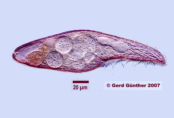 Blepharisma Phycokey Chilodonella images