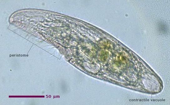 Blepharisma Protist Images Blepharismidae