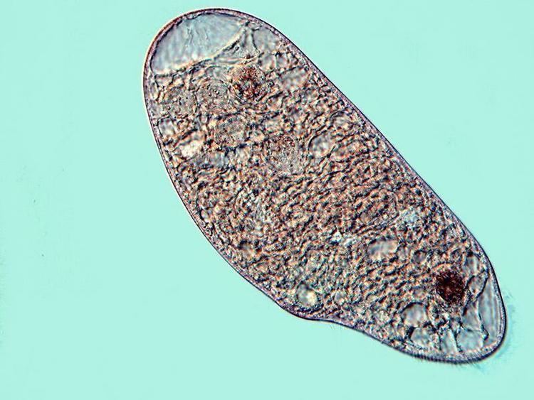 Blepharisma MicUK Two Marvelously Weird Ciliates Blepharisma and Climacostomum