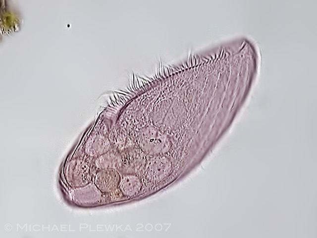 Blepharisma Freshwater and other microorganisms from Germany Blepharisma