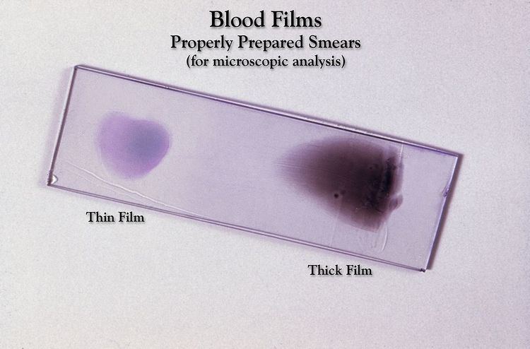 Blood film