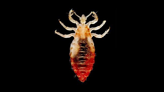 Body louse wwwhealthlinecomhlcmsresourceimagesClinicalL