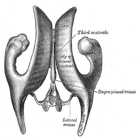 Body of lateral ventricle