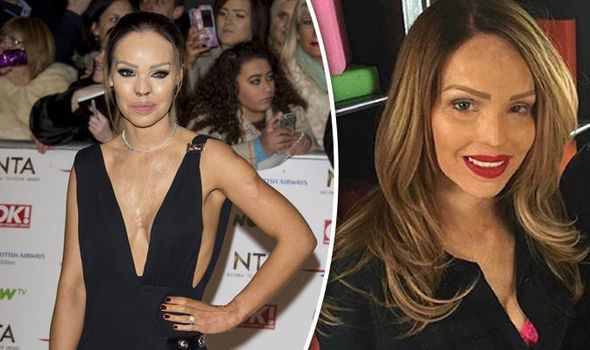 Bodyshockers Bodyshockers viewers praise brave Katie Piper for fronting show TV