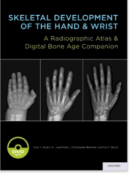 On the movie cover of Skeletal Development of the Hand & Wrist, on left is a radiographic image of the hand of a kid, in the middle a radiographic image of a teenager, at the right is the radiographic hand of an adult, and a DVD logo on the bottom left.