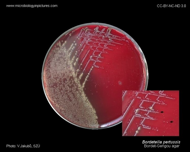 Bordet-Gengou agar wwwmicrobiologyinpicturescombacteriaphotosbor