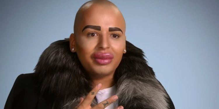 Botched (TV series) Kim Kardashian SuperFan Jordan James Parke Appears On TV Show