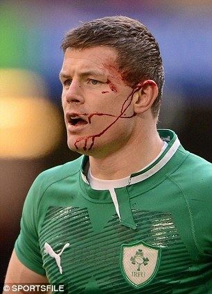 Brian O'Driscoll Brian O39Driscoll has suffered far too many concussions playing for