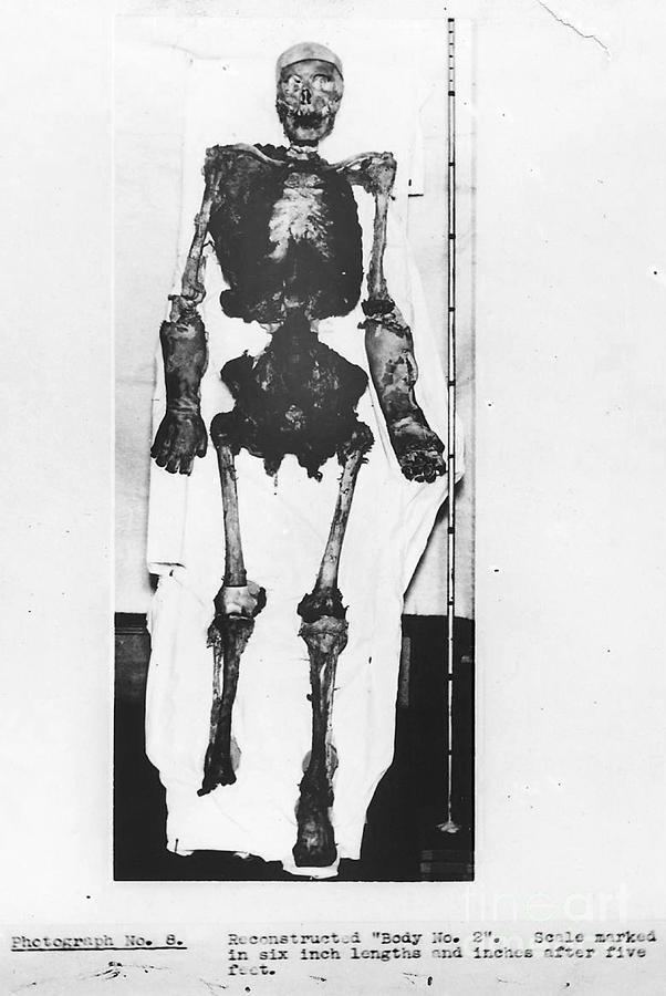 Buck Ruxton Skeletal Reconstruction Buck Ruxton by Science Source