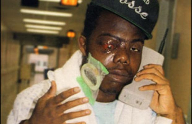 Bushwick Bill Lloyd Banks How 21 Rappers Responded To NearDeath