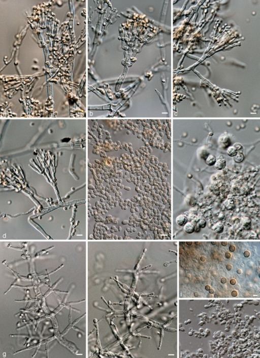 Byssochlamys Byssochlamys lagunculariae ad Conidiophores e co Openi