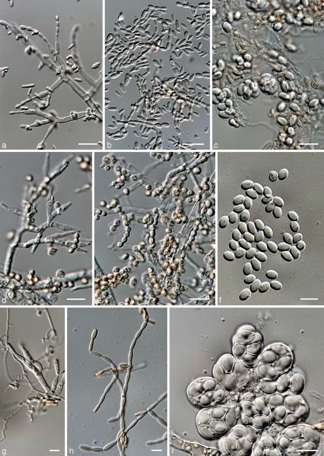 Byssochlamys Byssochlamys fulva a Conidiophores b conidia c asci and
