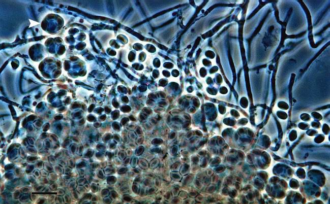 Byssochlamys Miniatlas mikroorganism