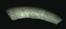 Caecum trachea httpsuploadwikimediaorgwikipediacommonsthu