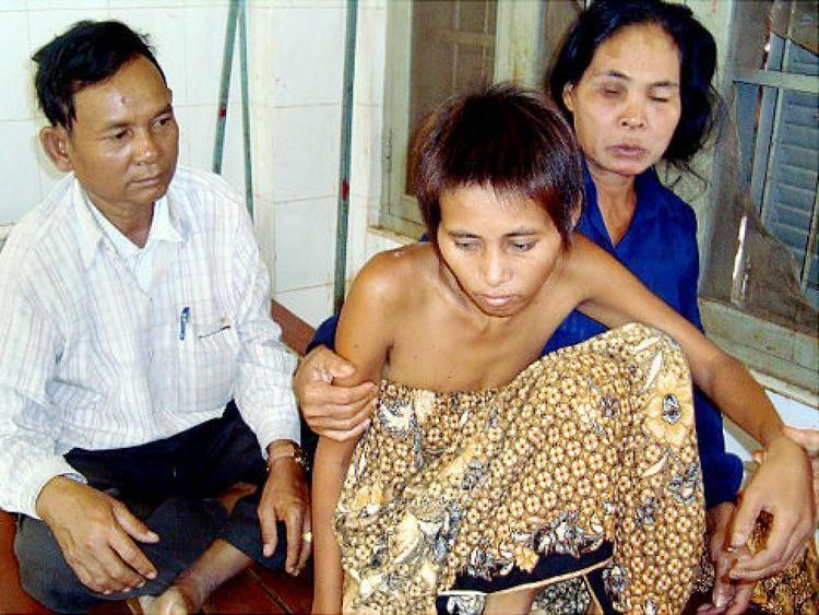 Sal Lou, Rochom P’ngieng, and Rochom Soy are sitting on the bed in the hospital in Ratanakiri province while P’ngieng is wearing a brown and black dress