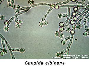 Candida albicans Yeast Infections Candida Albicans Essential Oils