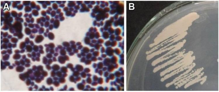 Candida auris Emerging multidrugresistant Candida auris information on infection