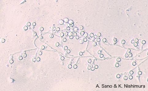 Candida dubliniensis wwwpfchibauacjpgalleryimgfungicCandidad