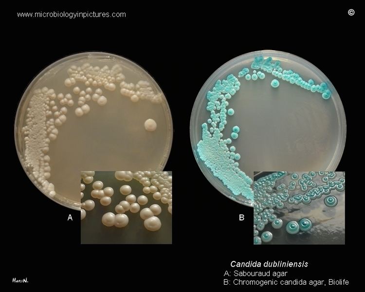 Candida dubliniensis Colony morphology and appearance of Candida dubliniensis on