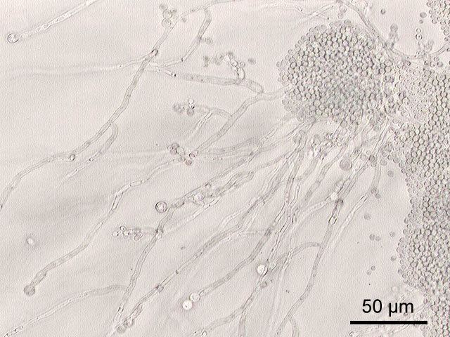 Candida (fungus) Candida fungus Wikipedia