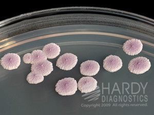 Candida krusei httpscataloghardydiagnosticscomcpprodconte