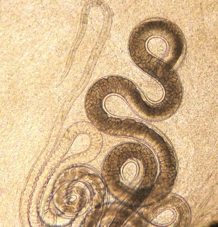 Capillaria (nematode) Capillaria nematode Images Video Information