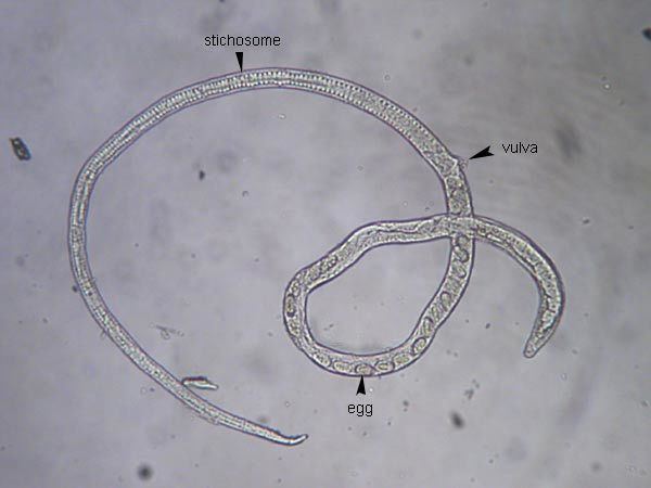 Capillaria (nematode) wwwmedicallabsnetwpcontentuploads201503Ca