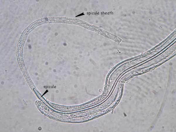 Capillaria (nematode) Capillaria Philippinensis Medical Laboratories