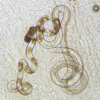 Capillaria (nematode) Capillaria nematode Images Video Information