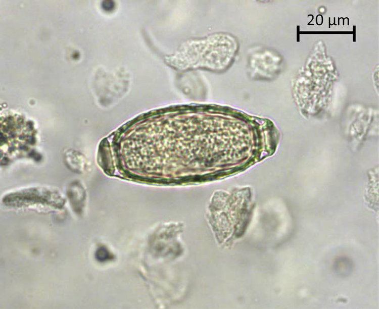 A typical barrel-shaped Capillaria plica egg in urine sediment from a... |  Download Scientific Diagram