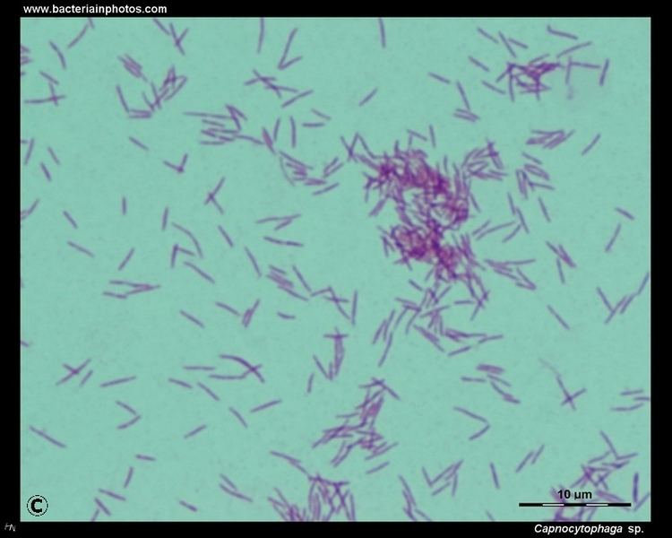 Capnocytophaga wwwbacteriainphotoscomlight20microscopy20of2