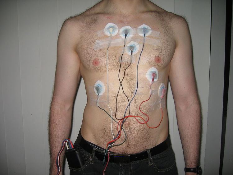 Cardiac monitoring