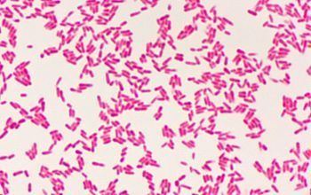 Cardiobacterium hominis Cardiobacterium hominis